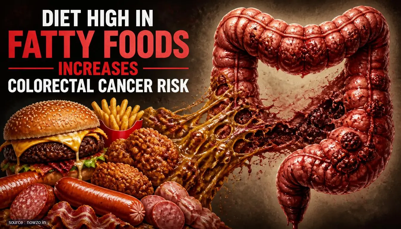 Fatty Food Linked to Colorectal Cancer Risk — Health news
