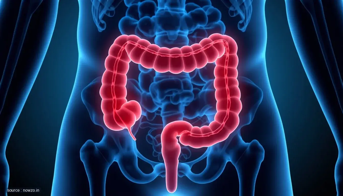 Rectal cancer non-surgical treatment trial results — Health news